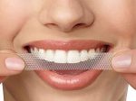 نوار چسب سفید کننده دندان روشی سریع در رفع لکه های دندان و سفیدی و درخشان کردن آن ها